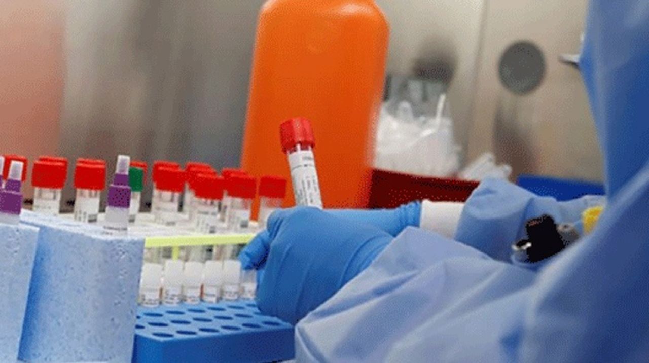 Virüse iyi gelen ilaç ücretsiz dağıtılacak