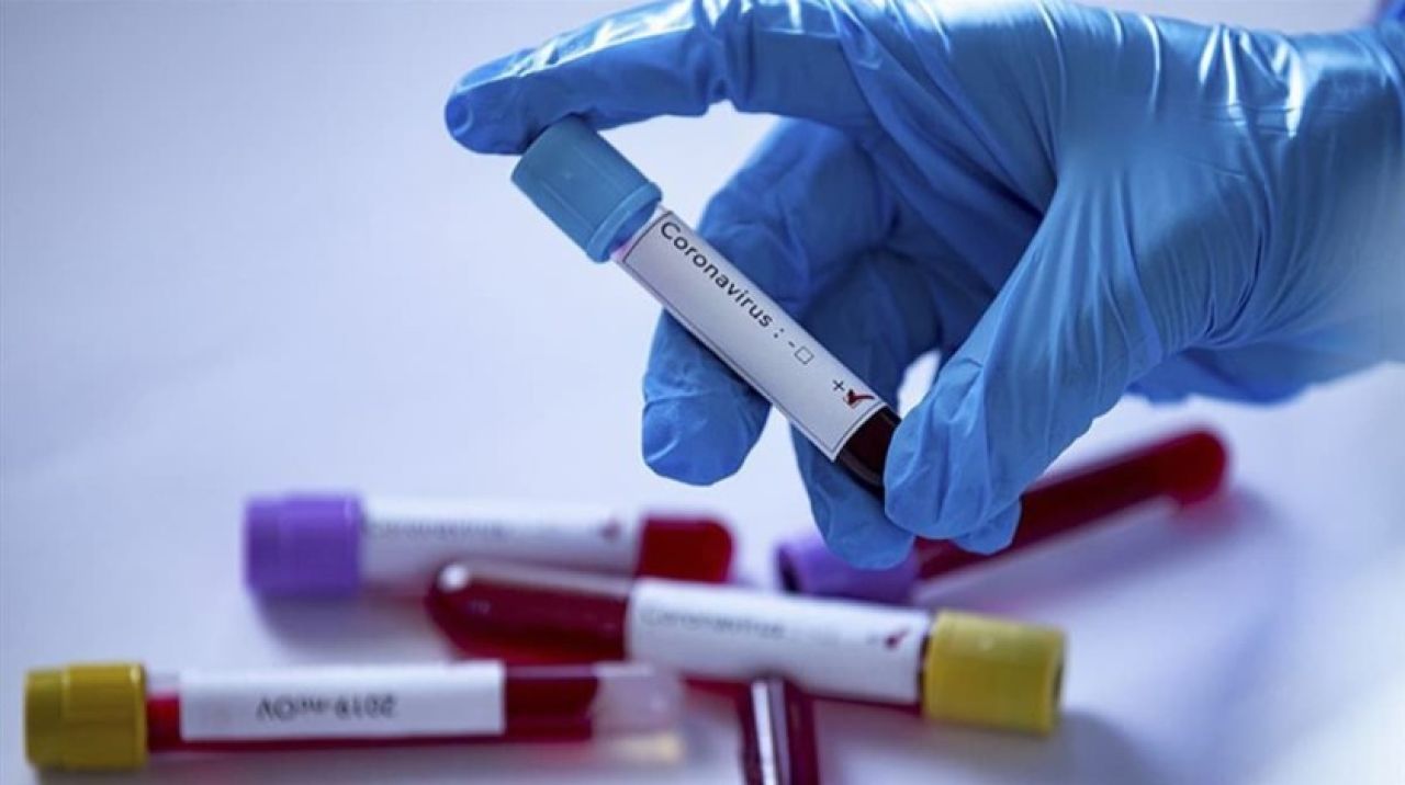 Ankaragücü'nde koronavirüs şoku!