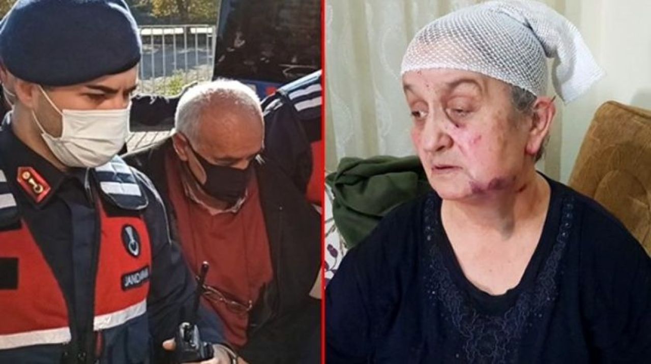 Hafize teyzeyi gasp edip bu hale getirdi