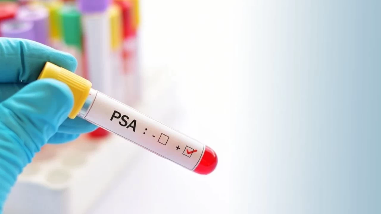 Narin Güran davasında geçen PSA nedir? PSA ne anlama geliyor?