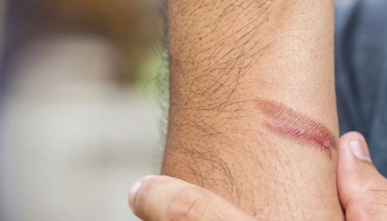 Herkesin evinde var, kimse bilmiyor! Yanık izlerini silip atan karışım