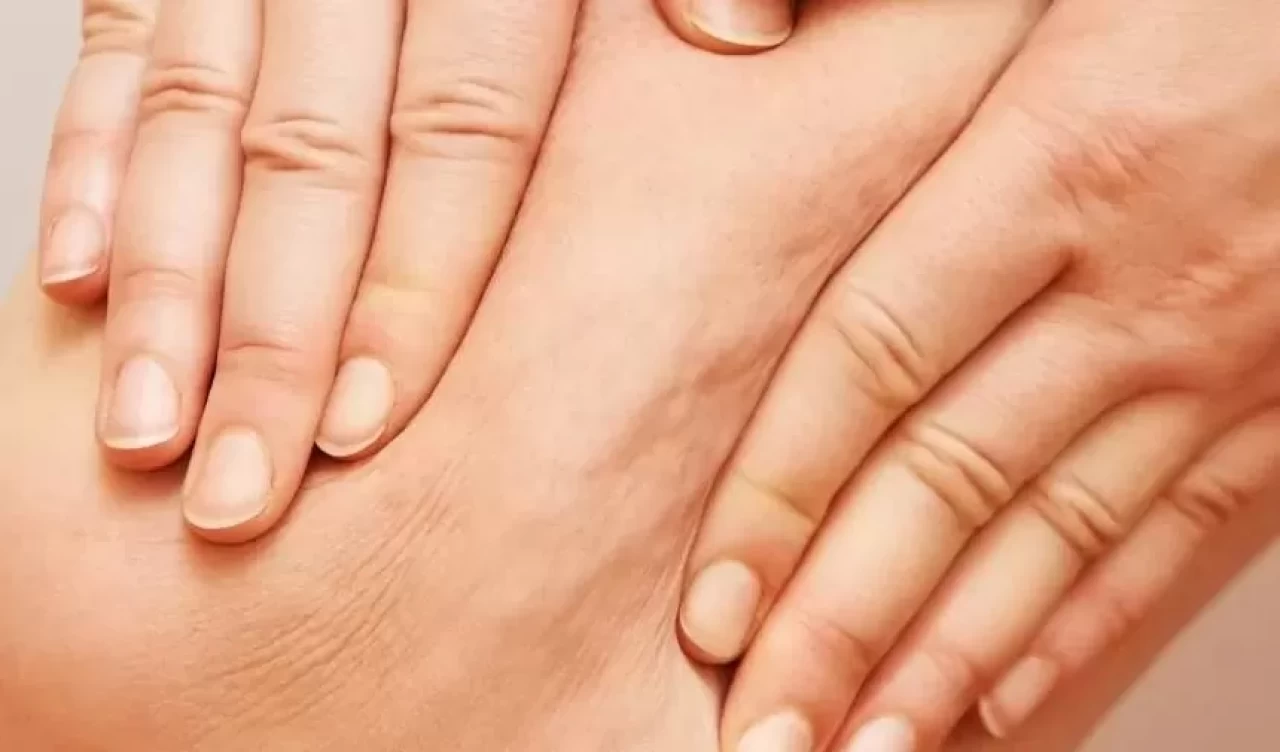 Selülit oluşumunu hızlandıran faktörler