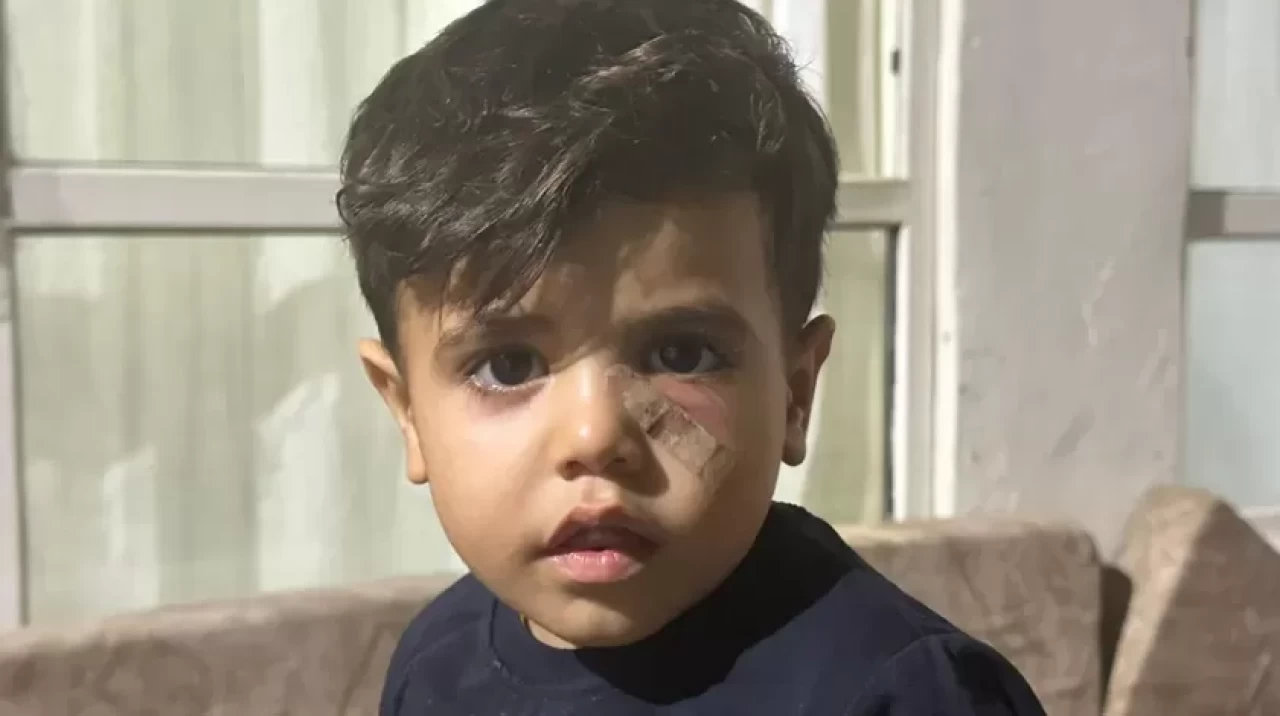Şanlıurfa'da dehşet! Yorgun mermi çocuğun gözünün altına isabet etti