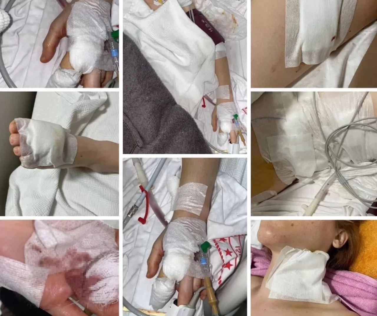 Erkek şiddeti bitmiyor! Üç gün önce uzaklaştırma talebinde bulunan mağdur kadın eski kocası tarafından 11 yerinden bıçaklandı