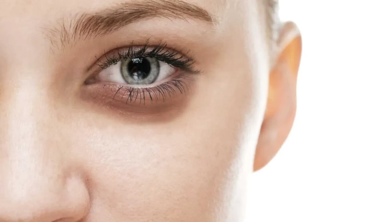 Uykusuzluğun izlerini silin! Bu üç malzeme yetecek