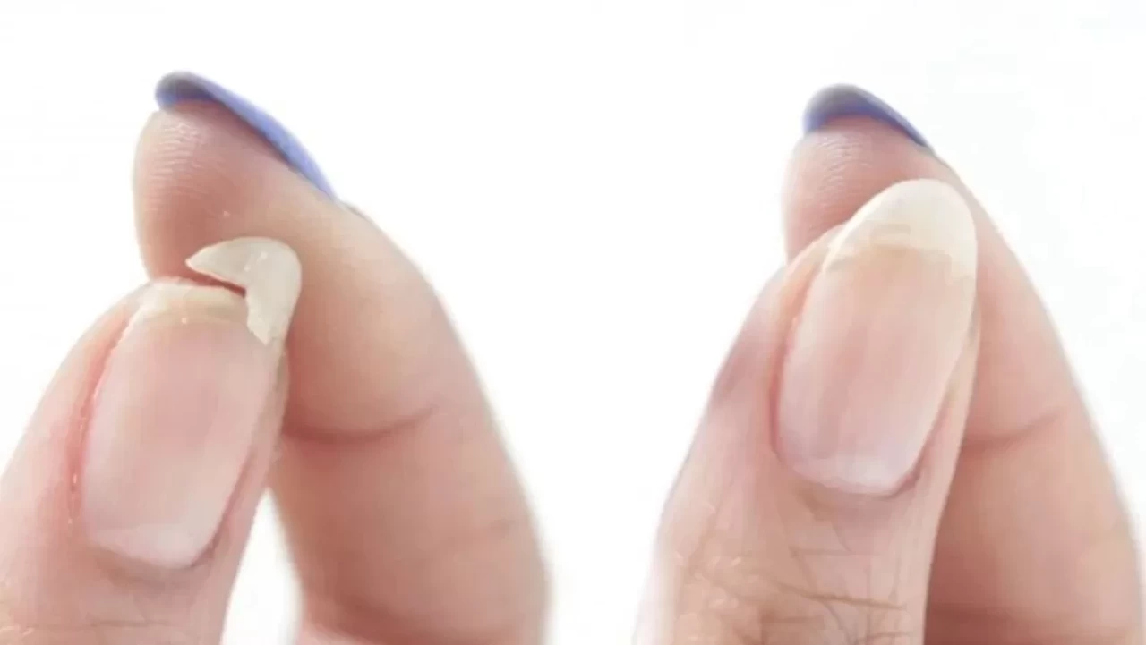 Kırık tırnaklara son! Bu mucize formülle tırnaklarınız eskisinden bile güçlü olacak!