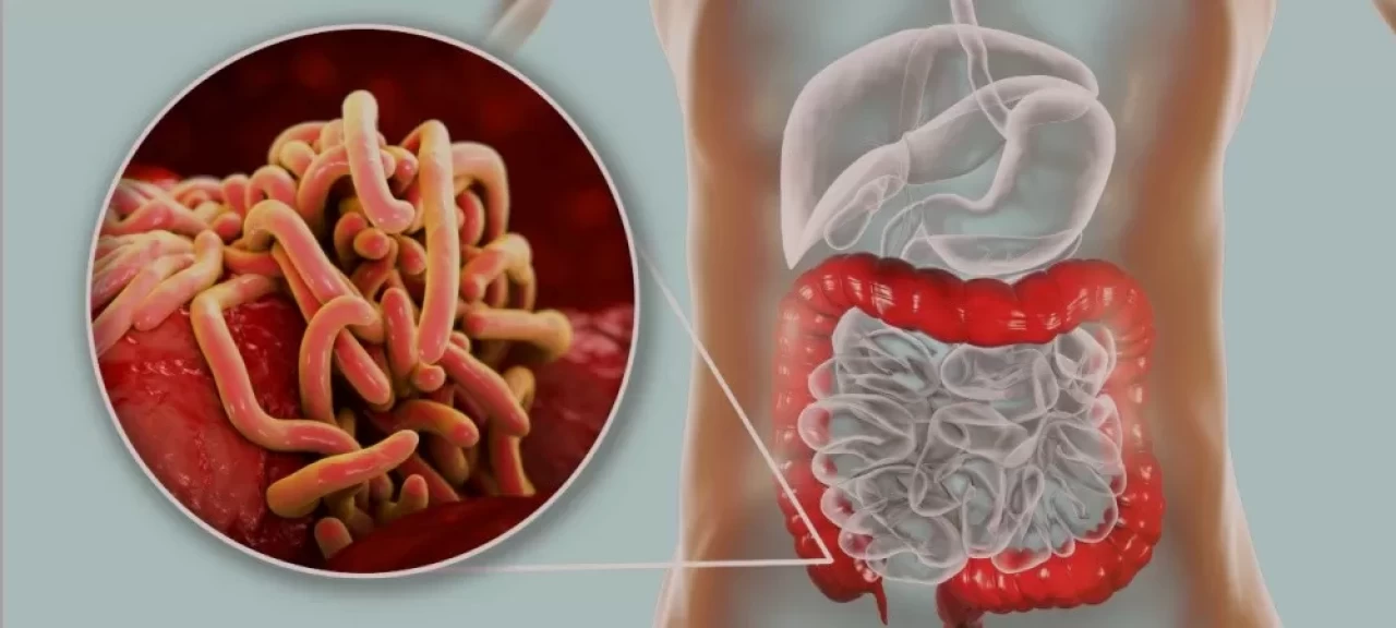 Hamilelikte Kıl Kurdu: Bebeğe Risk Oluşturur mu?