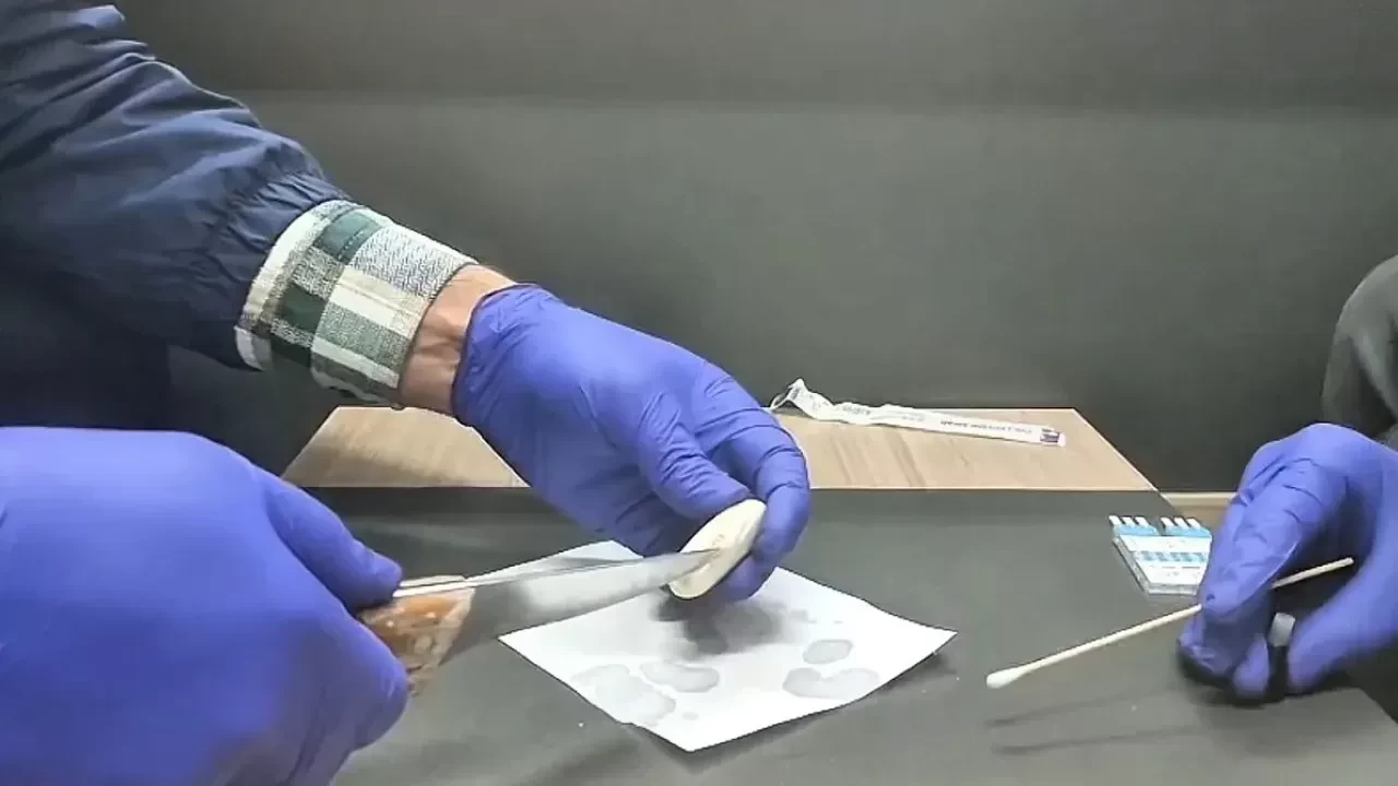 Kayseri’de uyuşturucu operasyonu! İranlı şüphelinin midesinden kapsüller çıktı