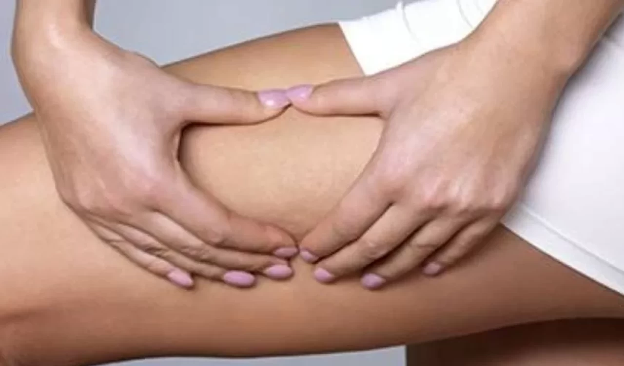 Selülitleri yok eden 6 basit egzersiz