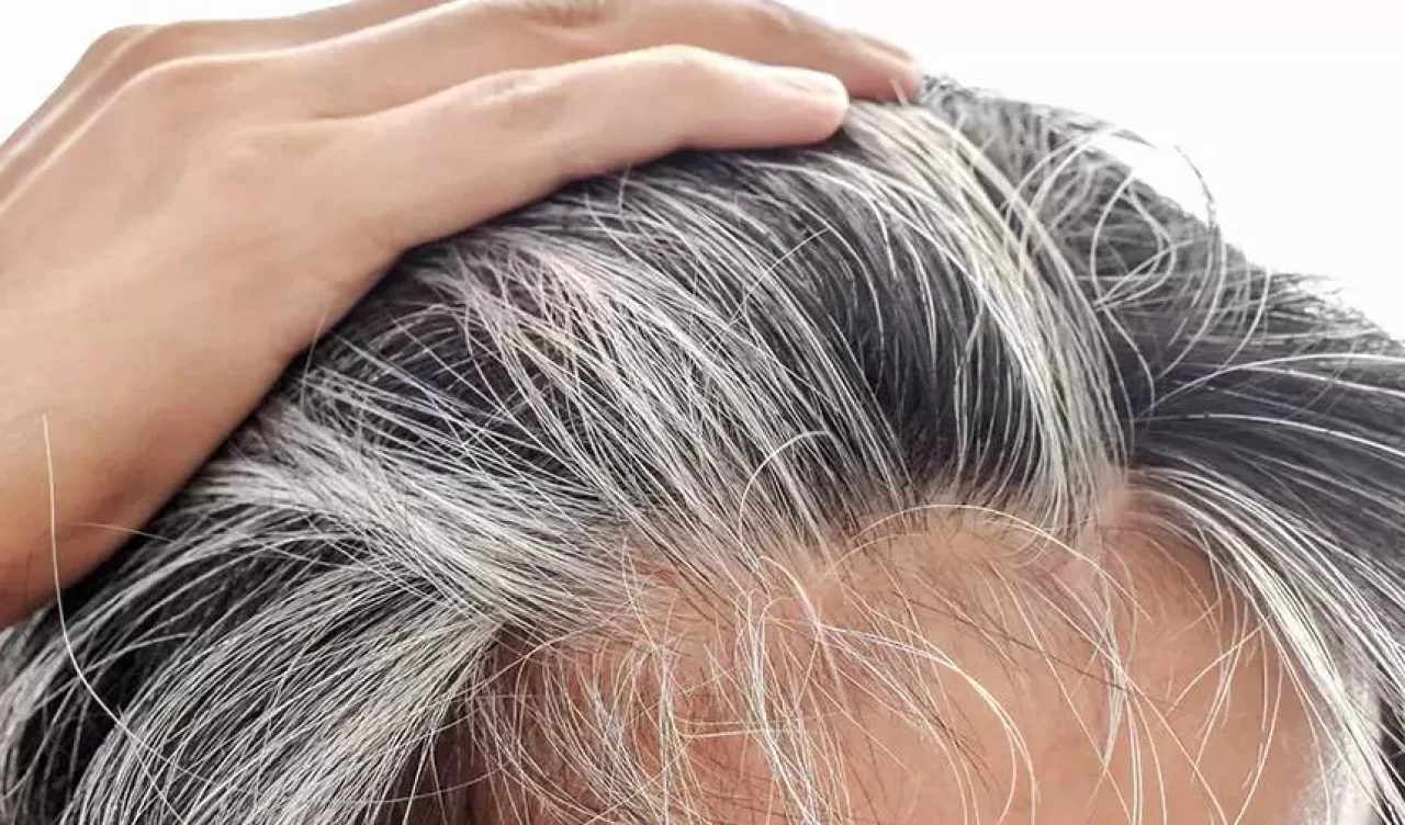 Saç beyazlamasını önlemenin 7 etkili yolu