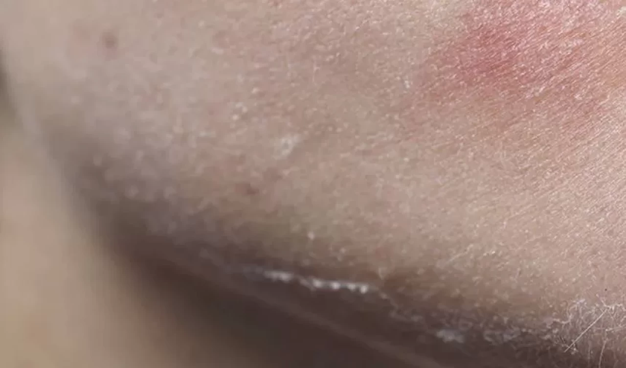 Kuru cilt kabusuna son! İşte 5 doğal çözüm