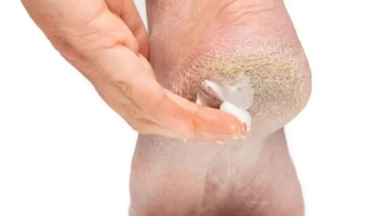 Evde Spa konforu! Kuru ve sert topuklara 5 doğal çözüm