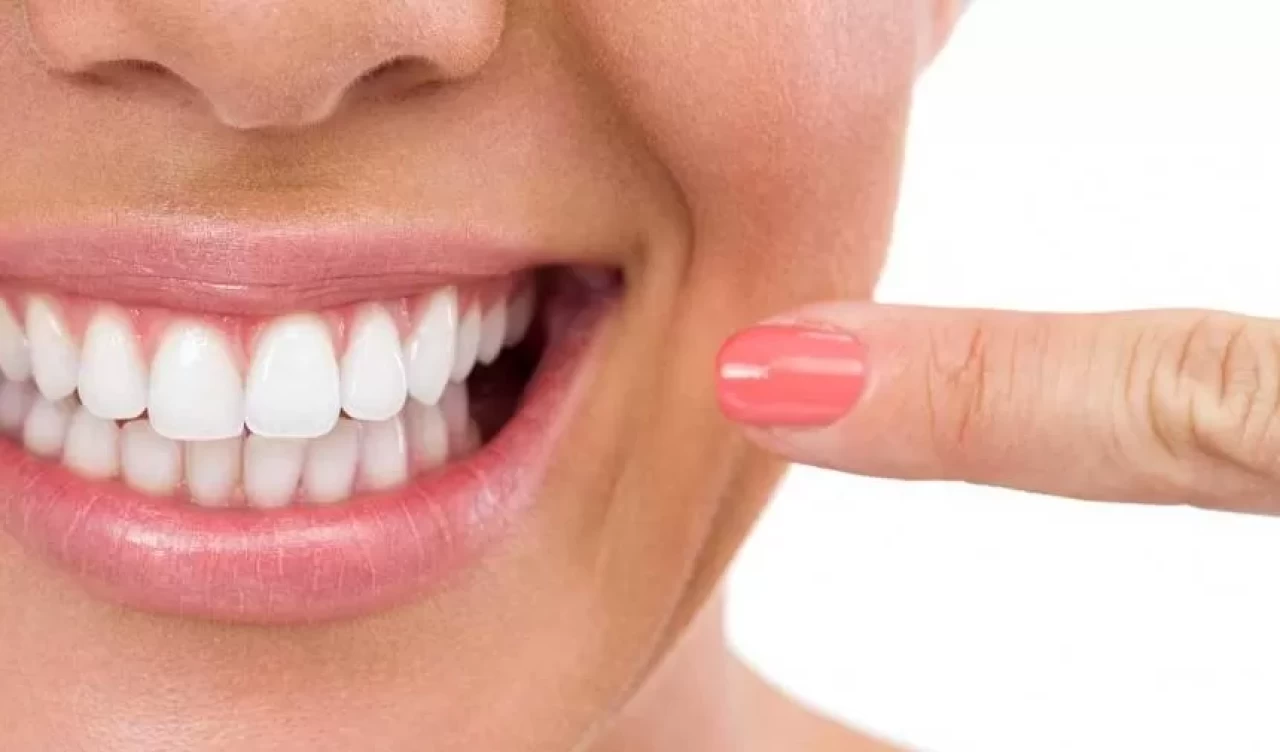 Dişleri beyazlatmanın en doğal ve kolay yolu