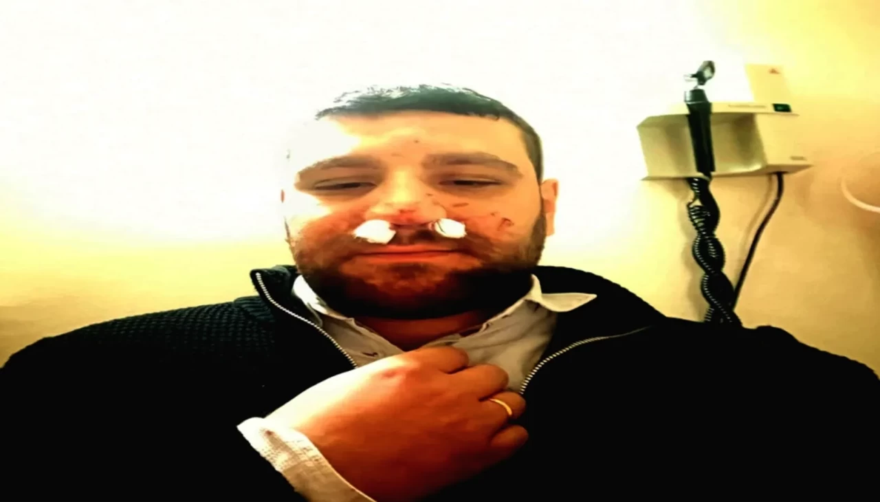 Ankara’da trafik kavgasında avukatın burnu kırıldı