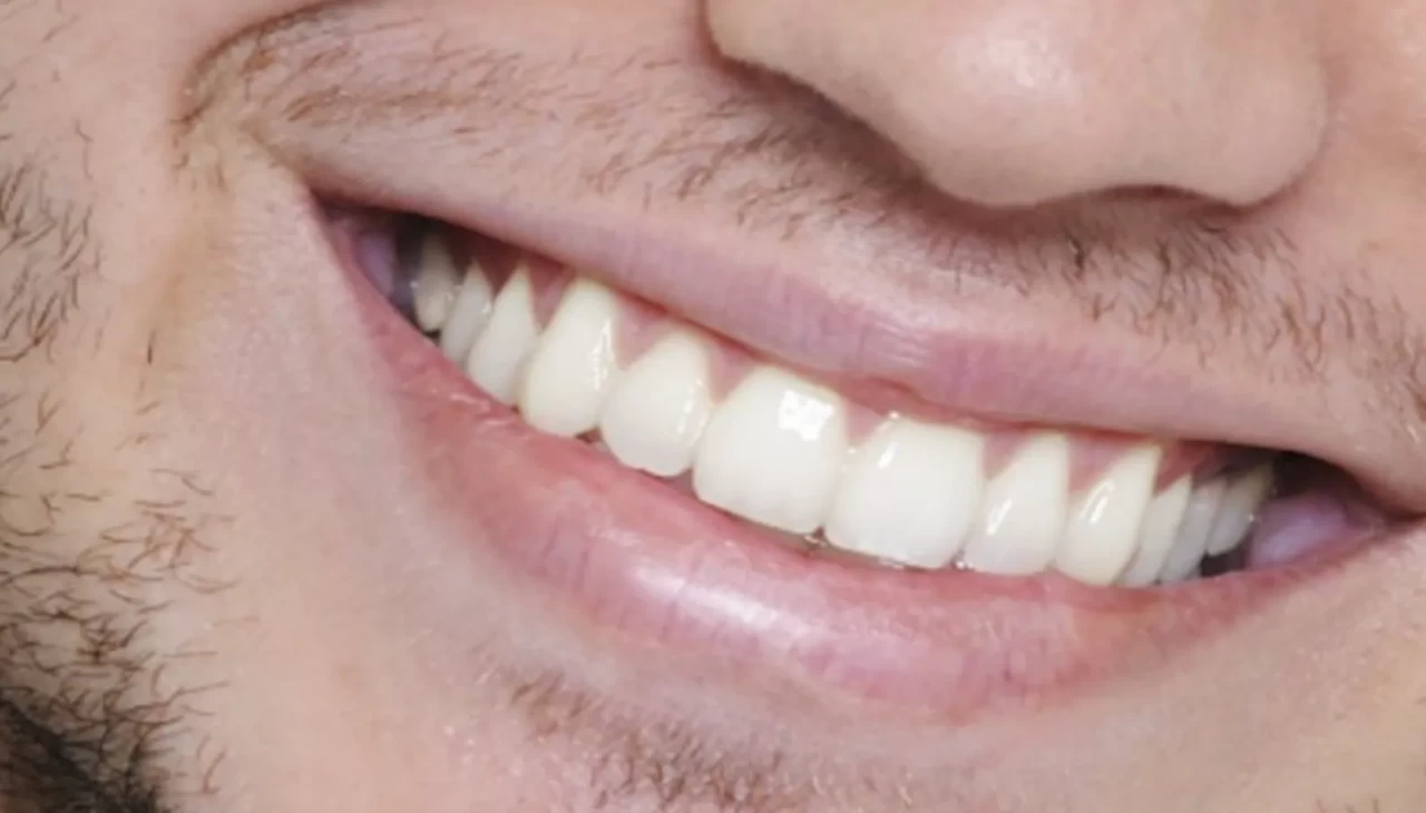 Bir lokmayla dişlerinizi kurtarın! Uzmanlardan mutfak tavsiyesi