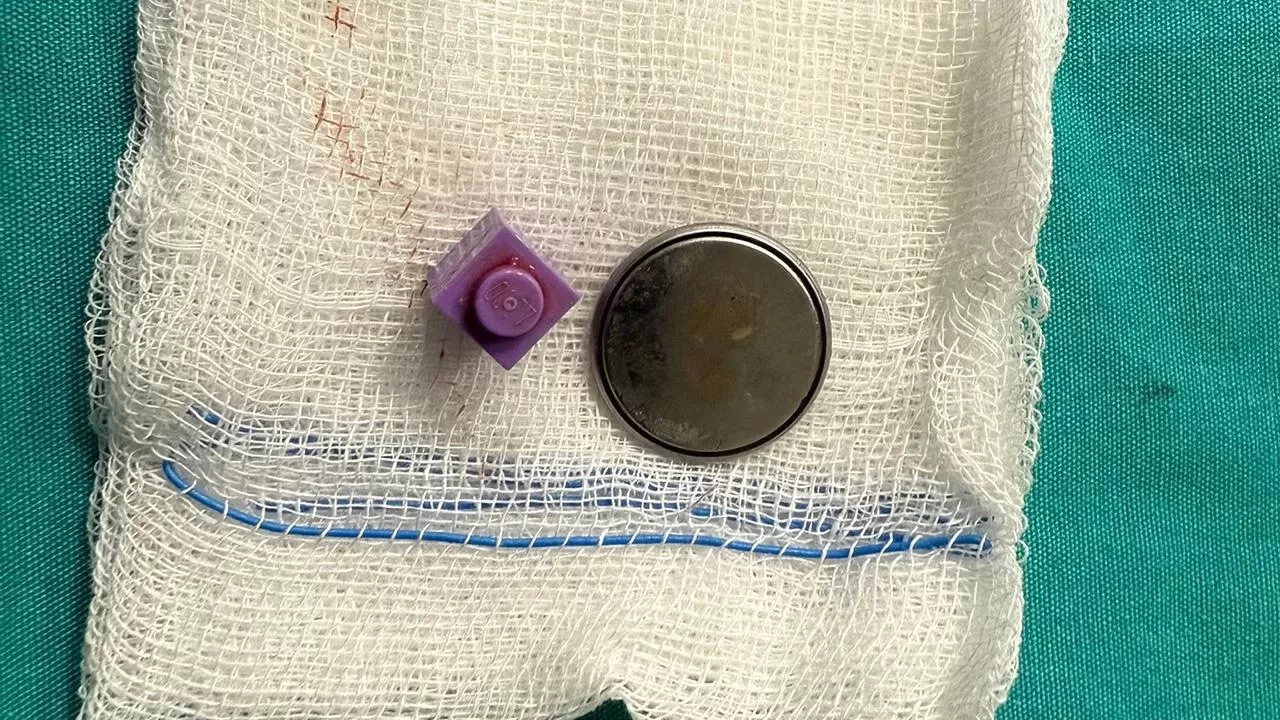 15 aylık bebek pil ve lego parçası yuttu! Ameliyatla hayata döndü