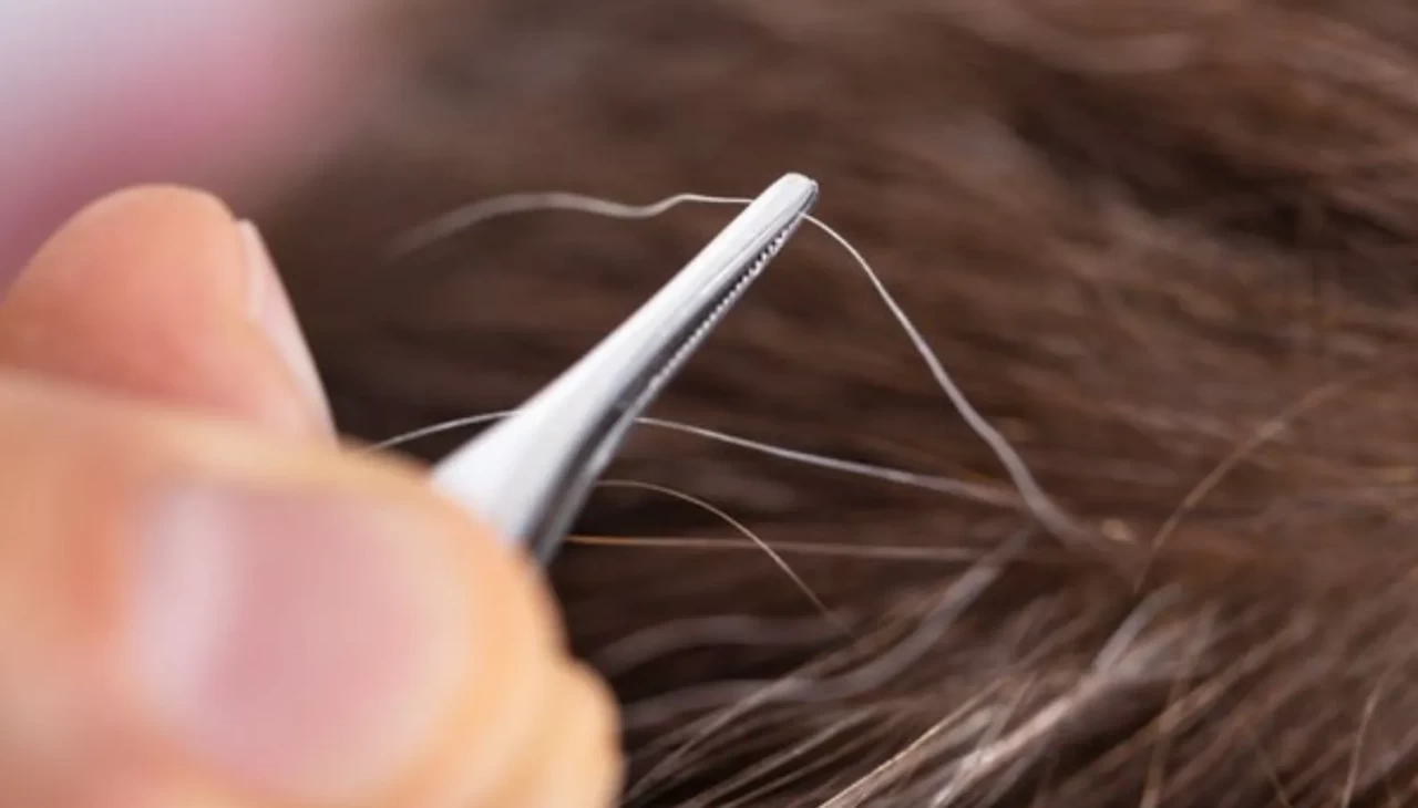 Saç kökünü çökerten yanlış! Beyaz saçı koparmanın sonuçları şaşırtıyor