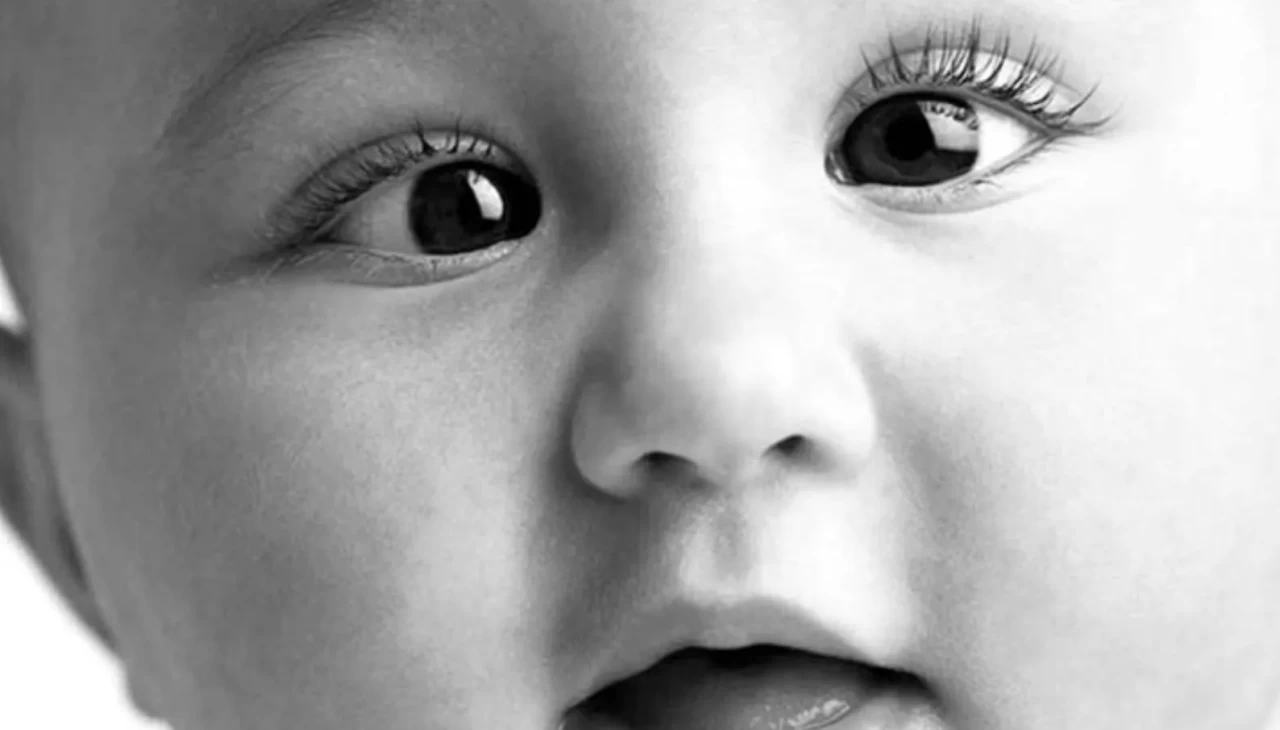 Bebeklerde göz kayması (Şaşılık) neden olur, nasıl anlaşılır? İşte uzman görüşleri