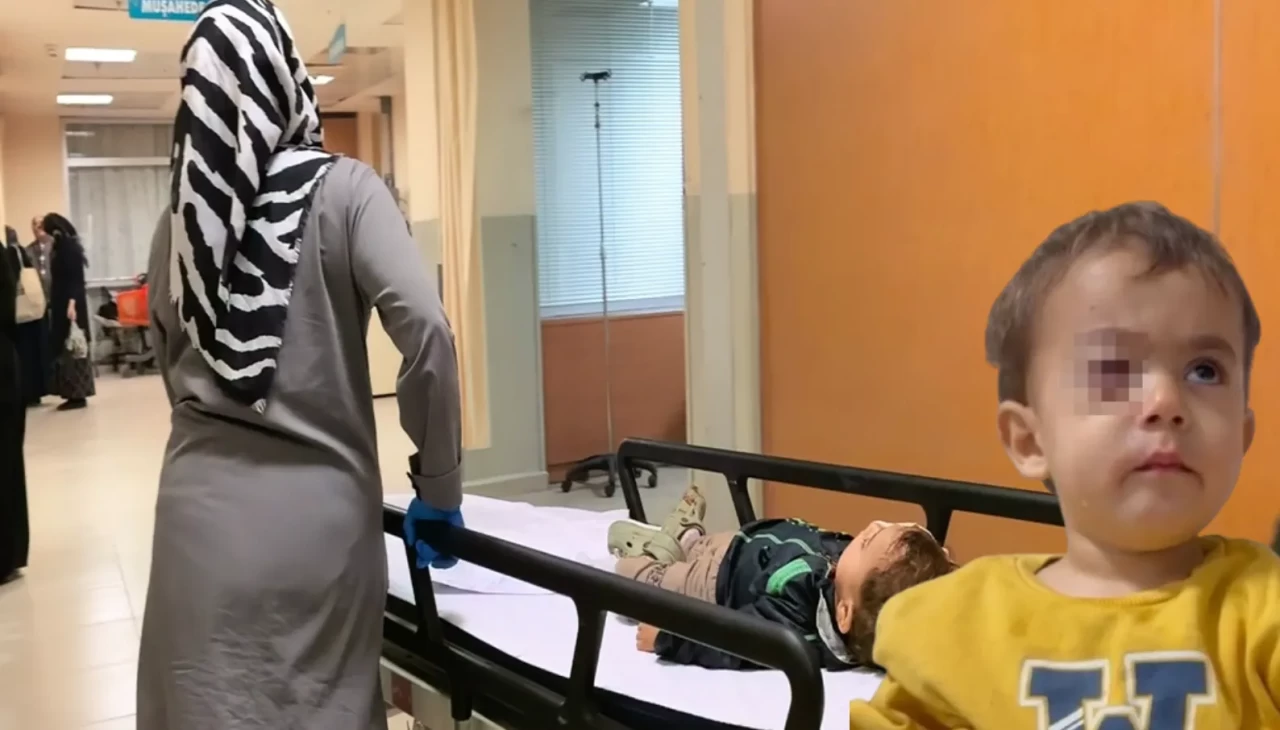 Fırından alınan torpil 2 yaşındaki Alpaslan'ın gözünü kör etti