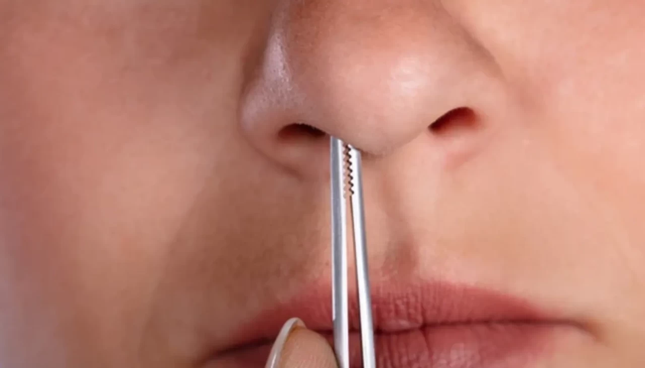 BURUN KILI KOPARMAK NEDEN TEHLİKELİ? UZMANLARDAN KRİTİK UYARI