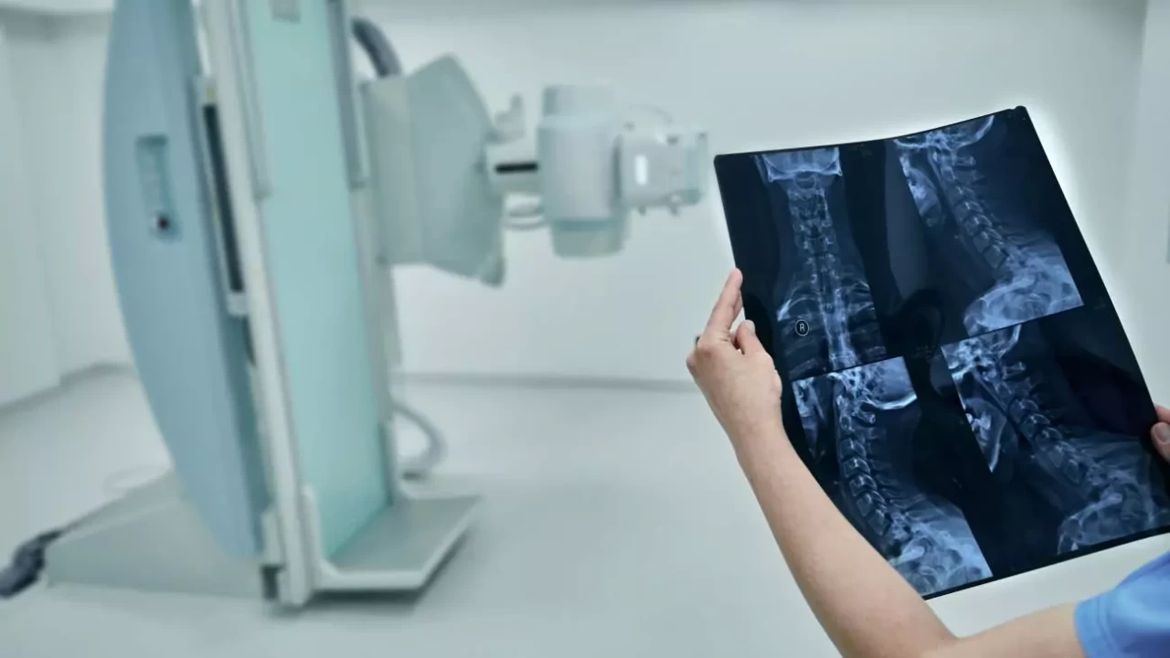 Modern tıpta dev adım: Radyoloji ile ameliyatsız tedavi dönemi başladı