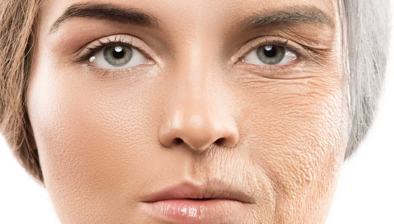 Kırışıklığı erken yakalamak mümkün mü? Gençlik çizgisini koruyan trend yöntem!