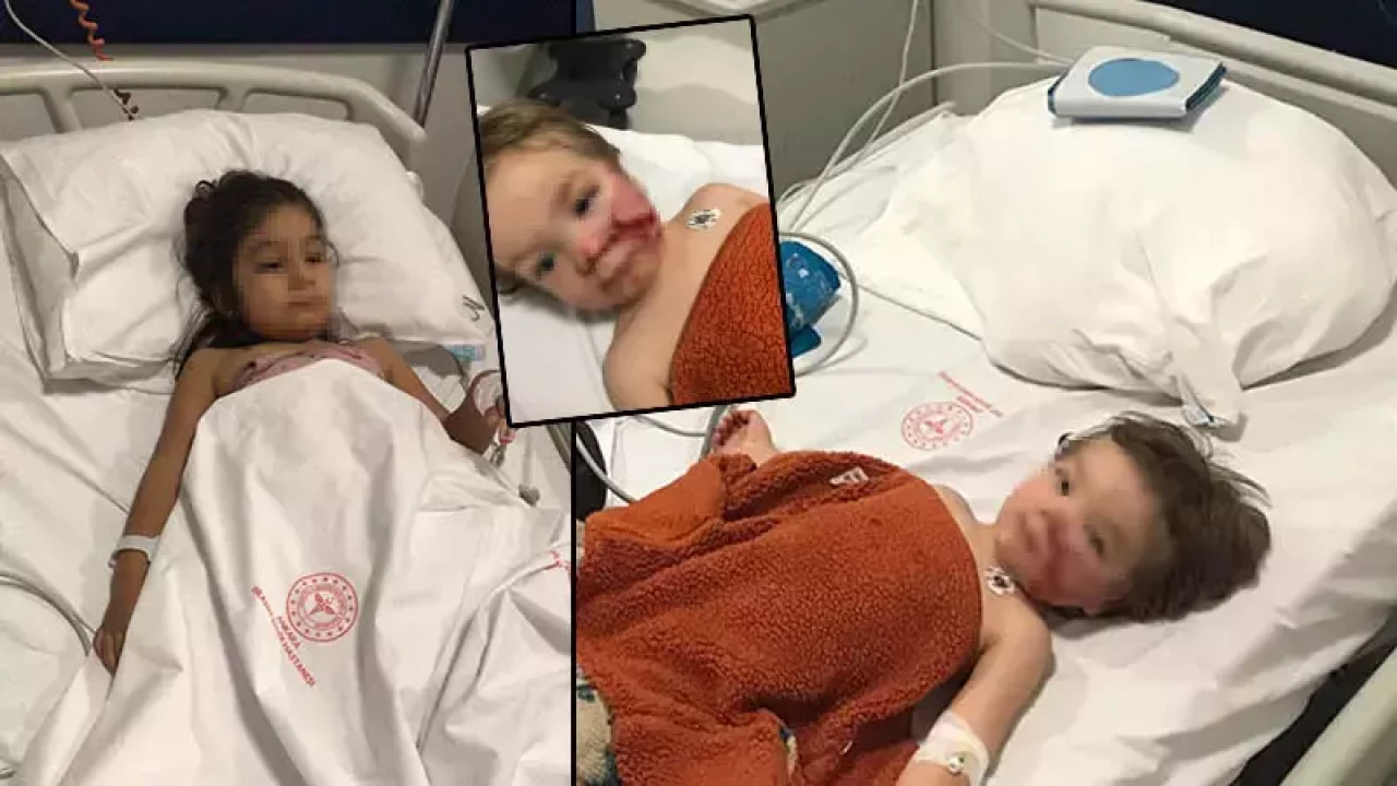 Pitbull, iki küçük kardeşe saldırdı: Köpeğin sahibi gözaltına alındı