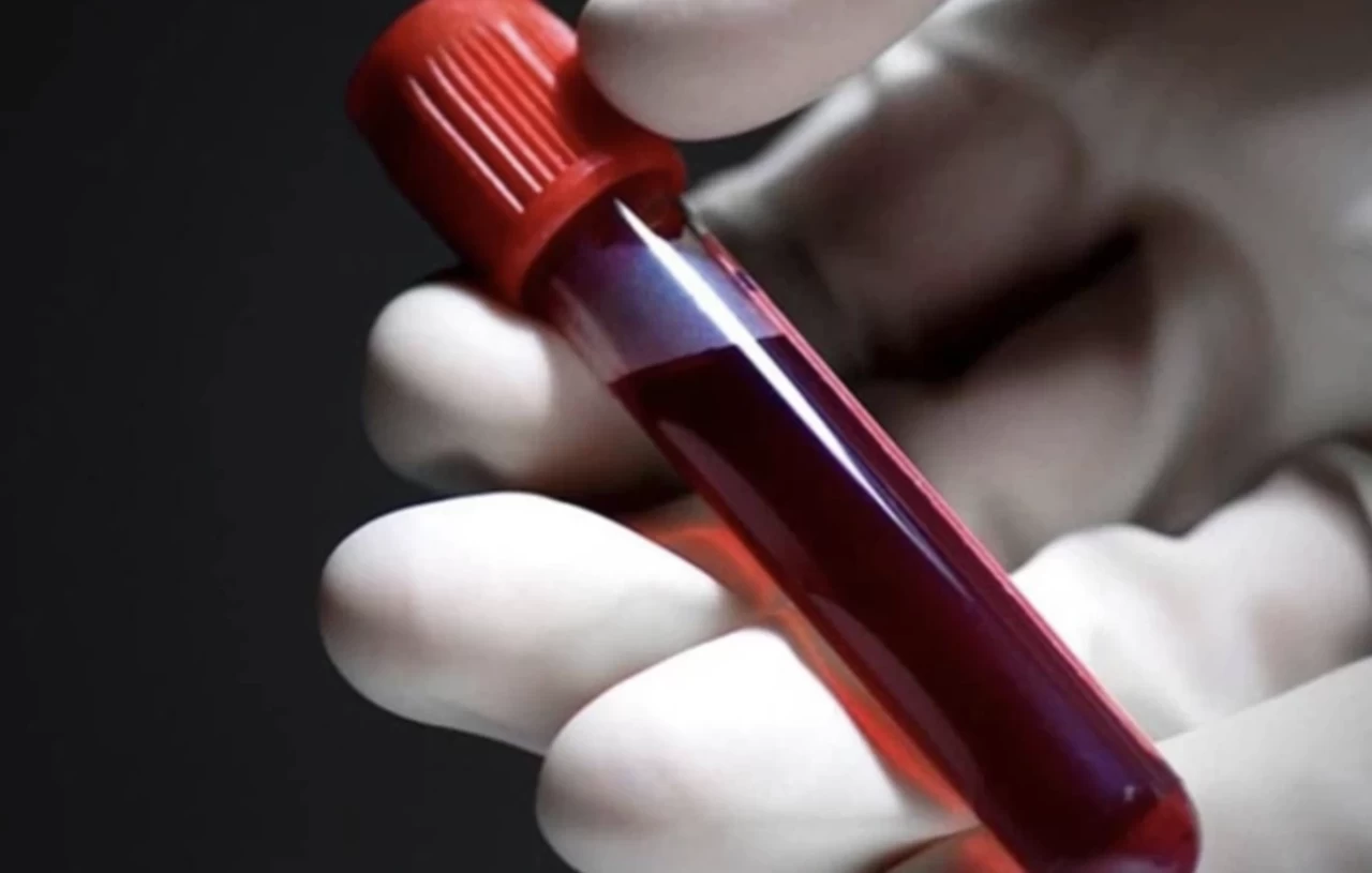 A Rh+ kan grubu olanlar daha çok mu hastalanıyor?