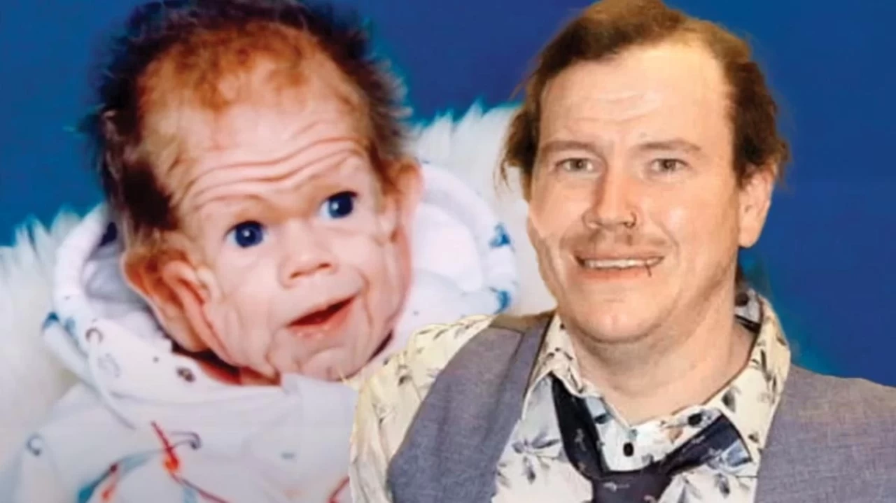 Benjamin Button gerçek oldu: Yaşlı doğdu zamanla gençleşti