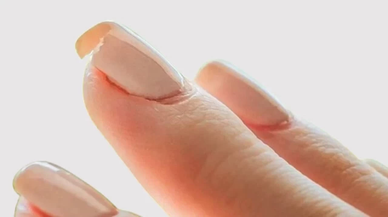 Tırnakların Çabuk Kırılmasının Nedenleri ve Çözüm Yolları