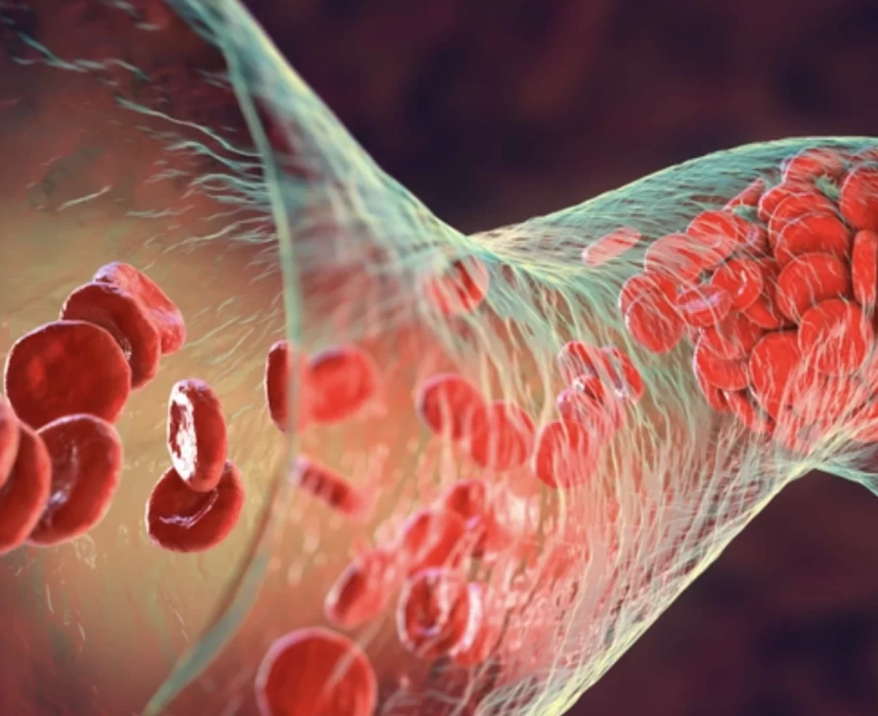 Eritrosit düşüklüğü nedir, belirtileri nelerdir?