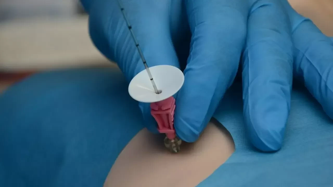 Biyopsi Orucu Bozar mı? Diyanet'in Görüşü Nedir?