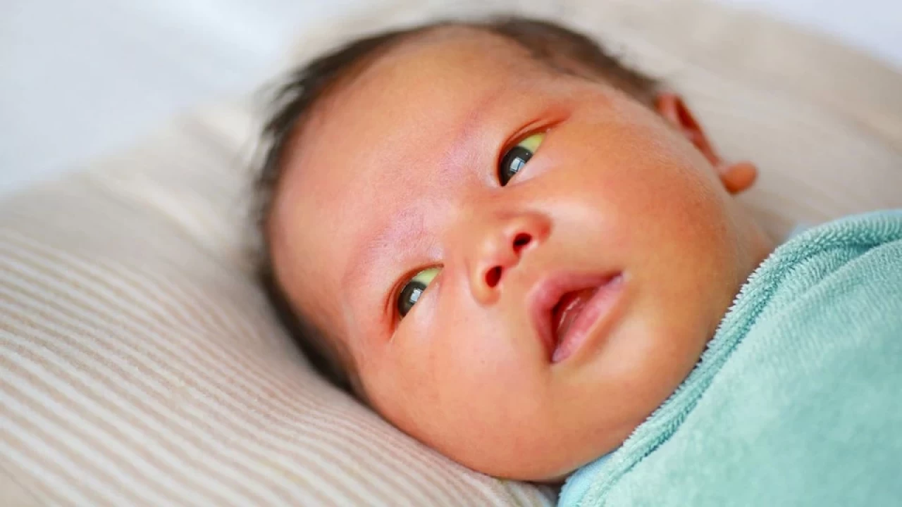 Bebeklerde Sarılık Nedir? Neden Olur ve Nasıl Tedavi Edilir?