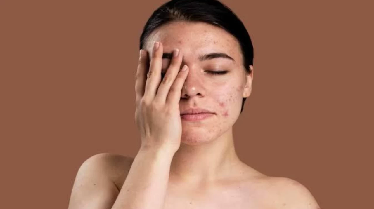 Cilt bakımı hakkında yapılan 5 büyük yanlış