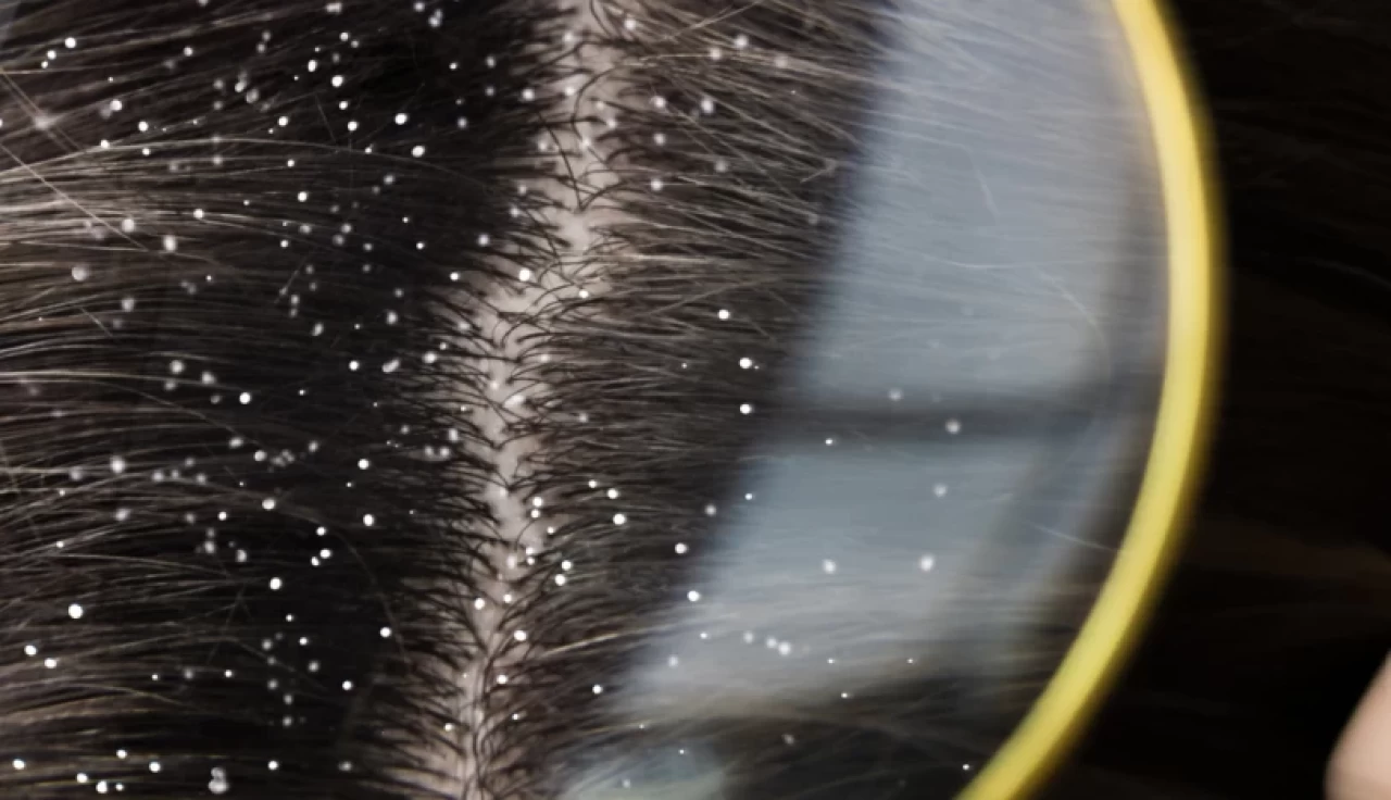 Saçınızı hangi sıcaklıkta su ile yıkamalısınız?