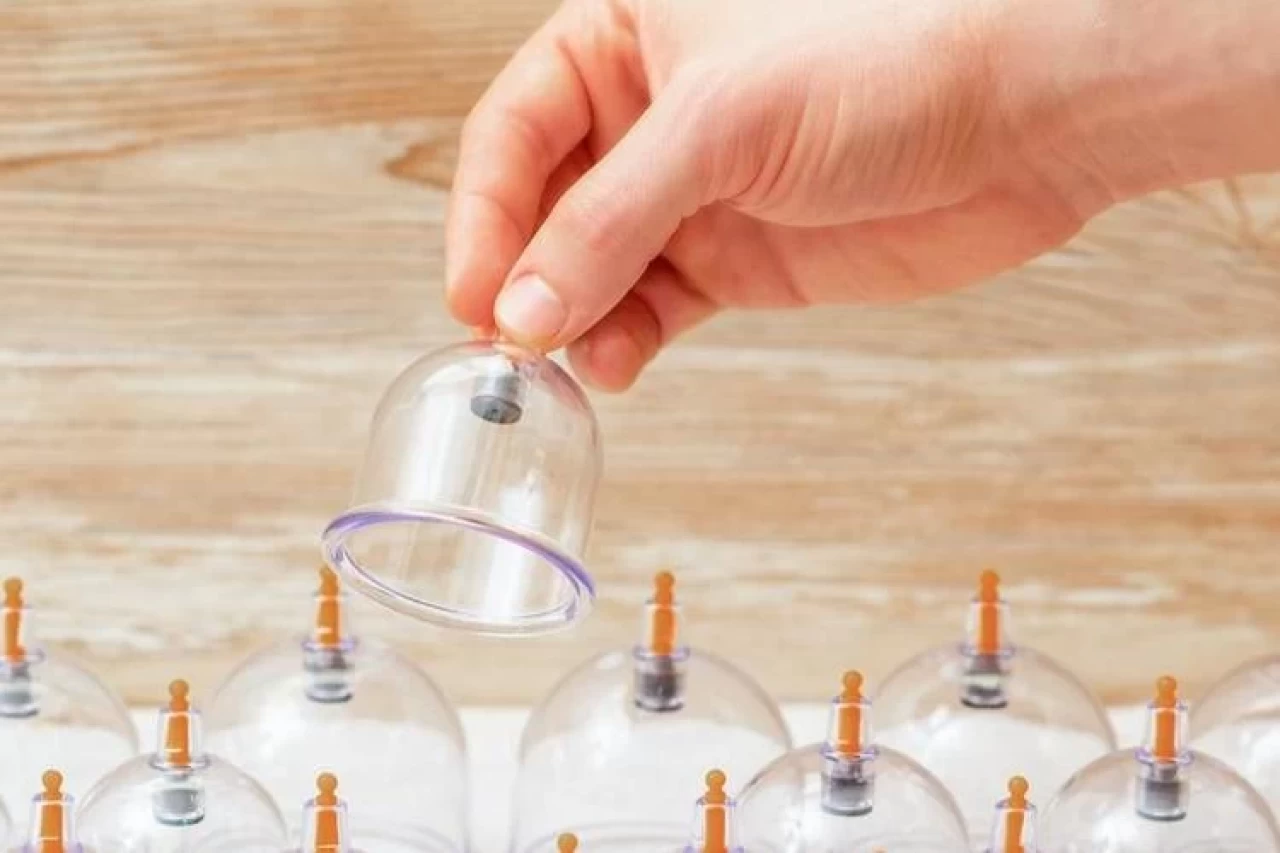 Şubat 2025 Hacamat Günleri Ne Zaman? Hacamatın Faydaları