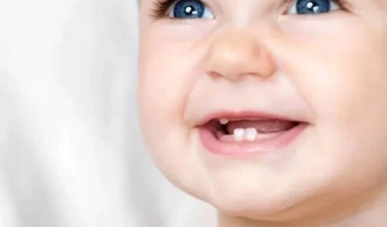 Bebeklerde diş ağrısına iyi gelen doğal yöntemler