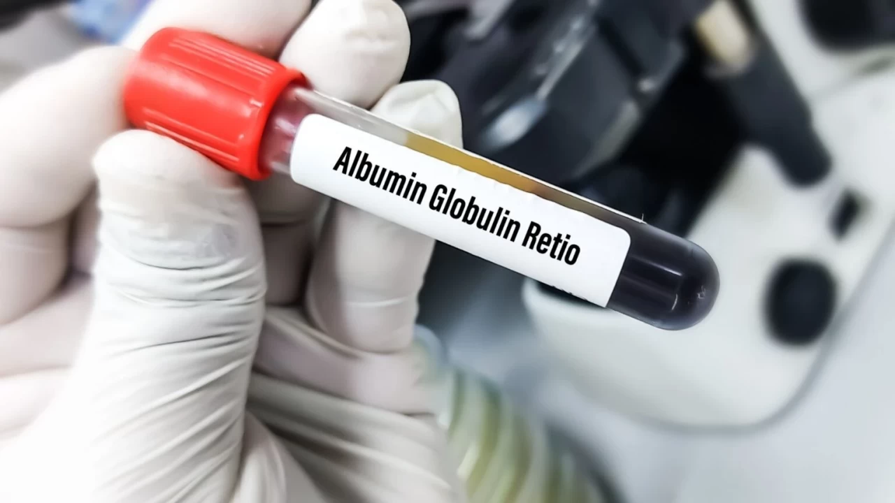 Globulin nedir?