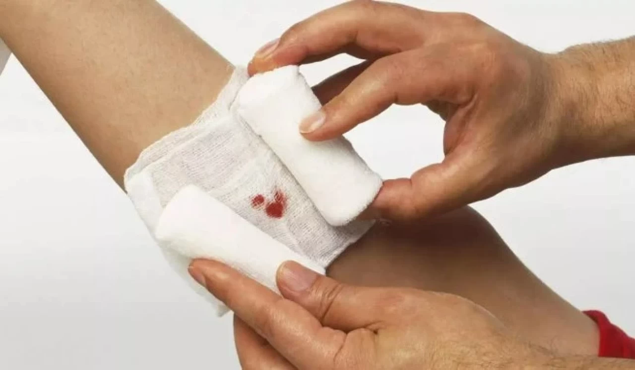 Açık yaraya kolonya dökülür mü?