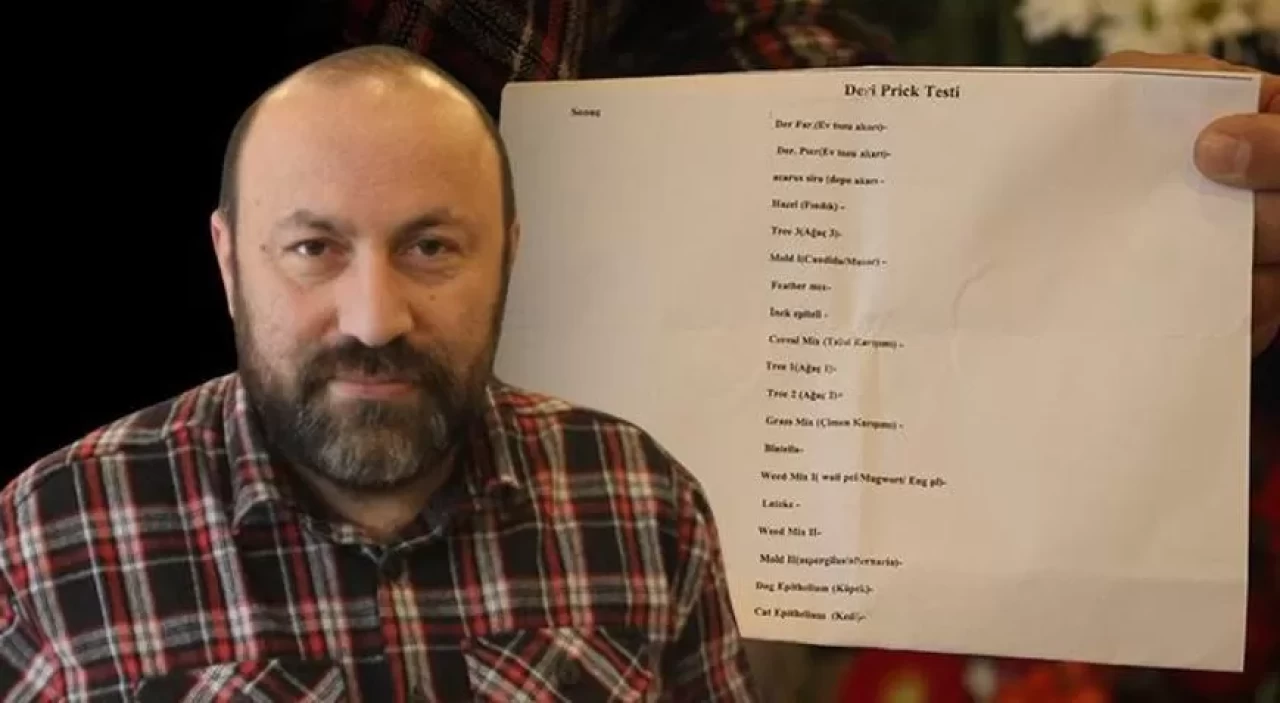 Test yaptırdı, 25 yıllık mesleğine alerjisi olduğu ortaya çıktı