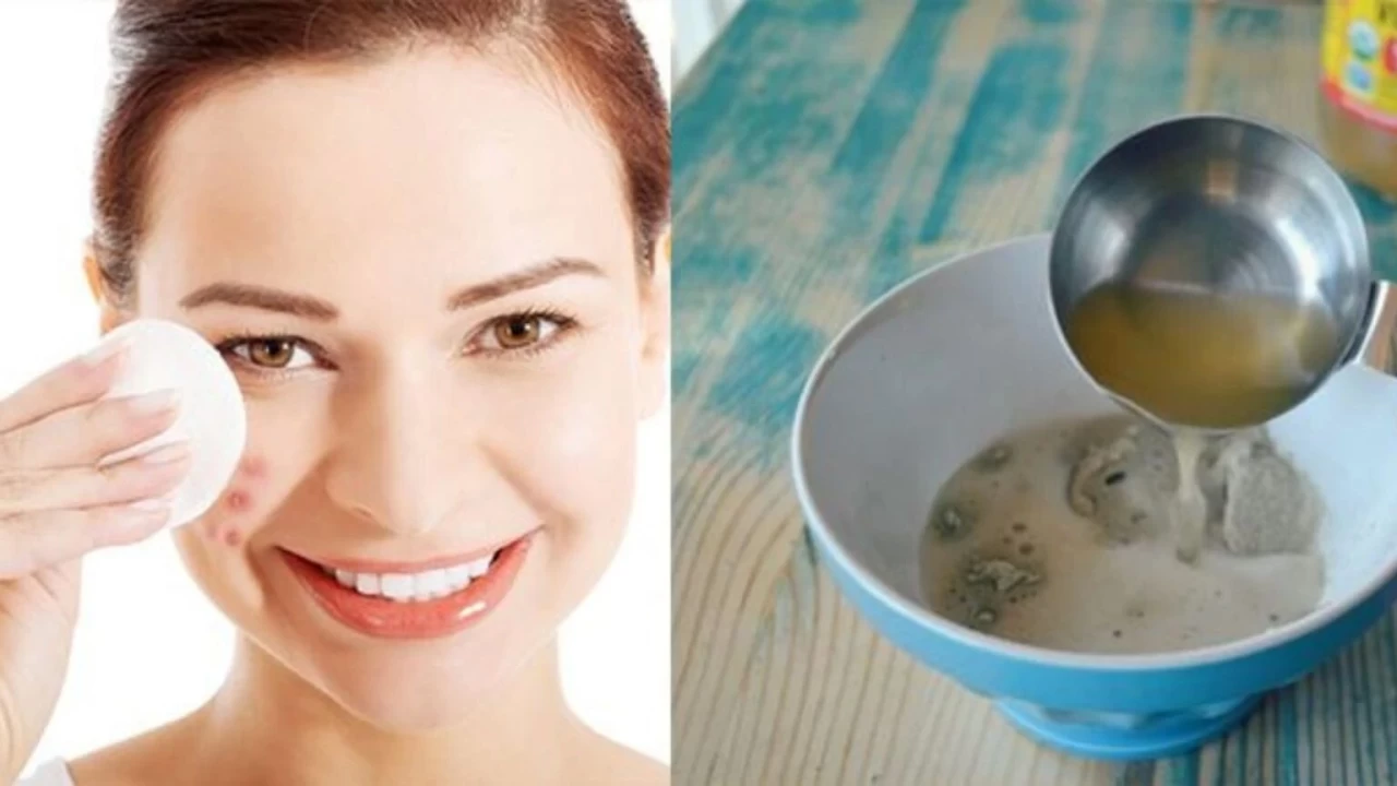 Yağlı ciltlere gözenek sıkılaştıran ev yapımı maskeler