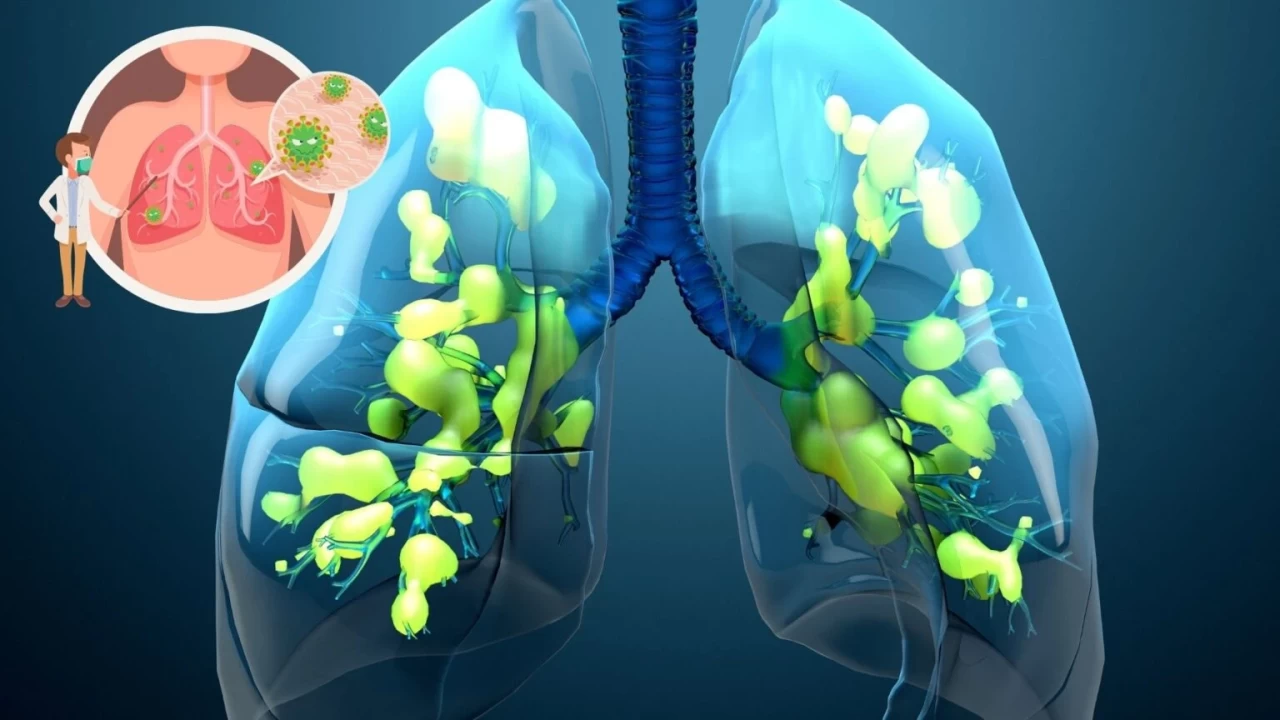 Zatürre kaç günde geçer? Üşütmekle zatürre olunur mu?