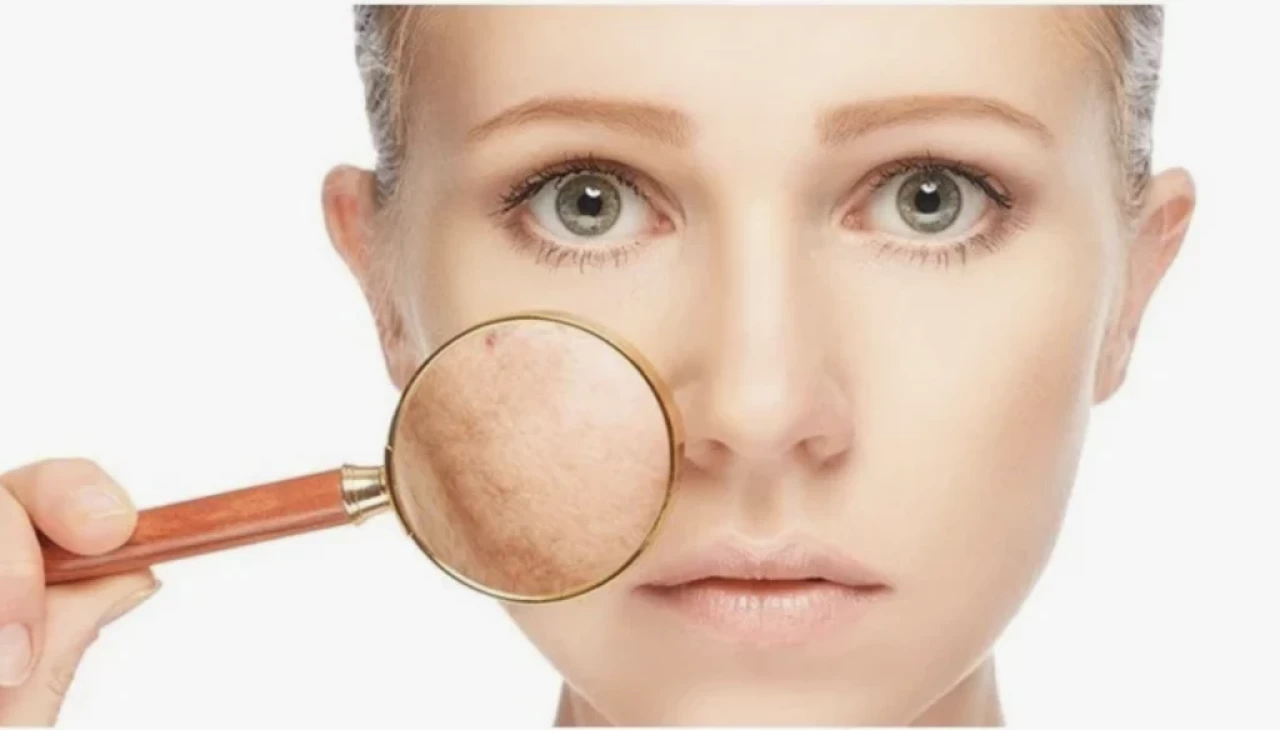 Bir damlasıyla yüzdeki kararmaları önleyen karışım!