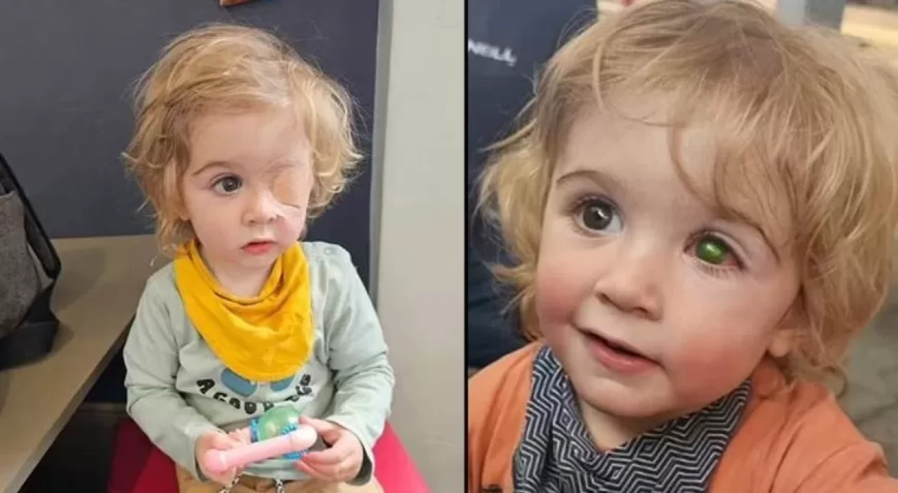 Bir öpücük yüzünden kör oldu!