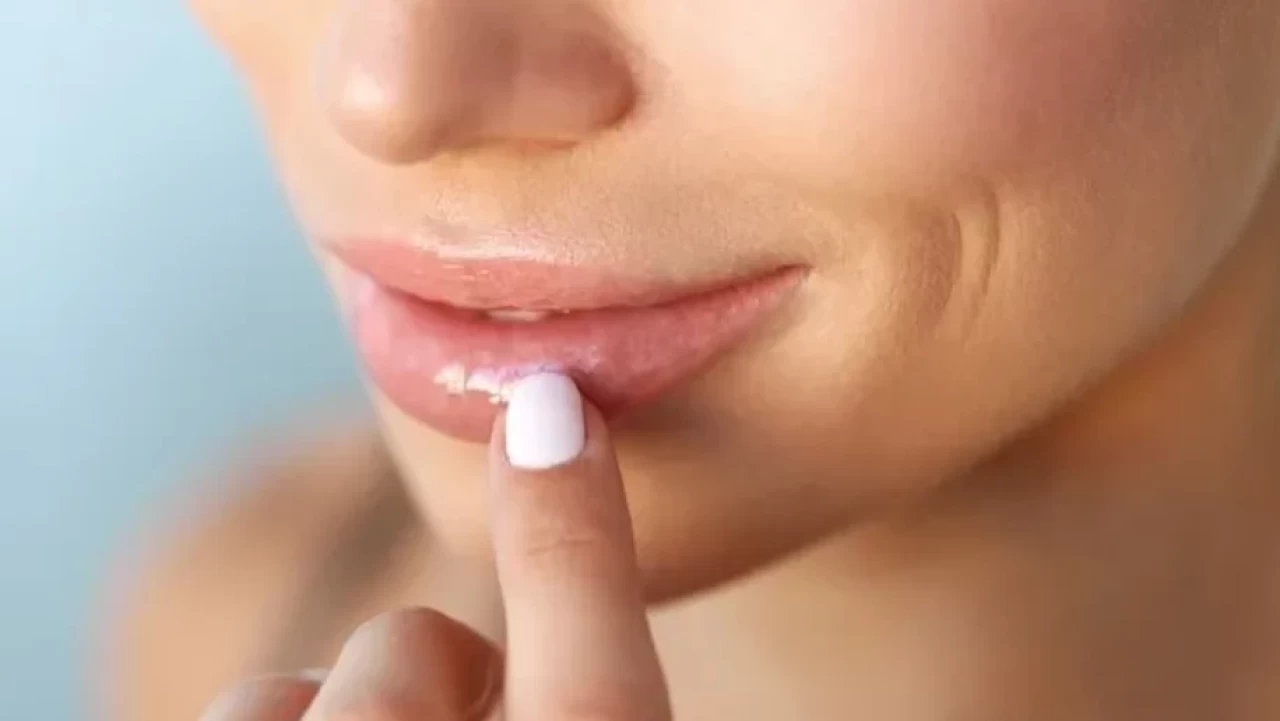 Dudak çevresindeki kırışıklıklarına iyi gelen bitkisel çözümler