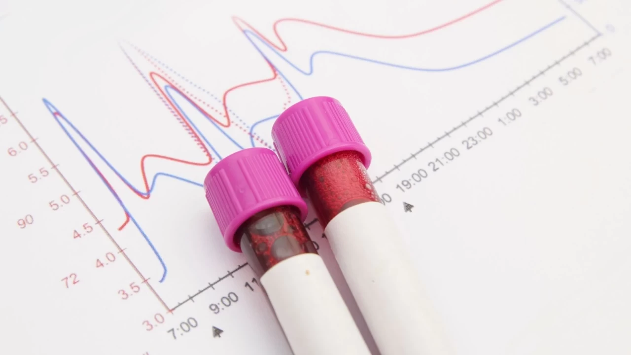 Direkt bilirubin yüksekliği neden olur?