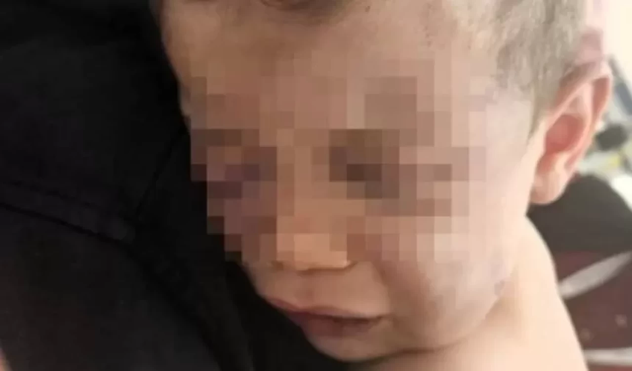 Denizli'de vahşet! Aile ve Sosyal Hizmetler Bakanlığı harekete geçti