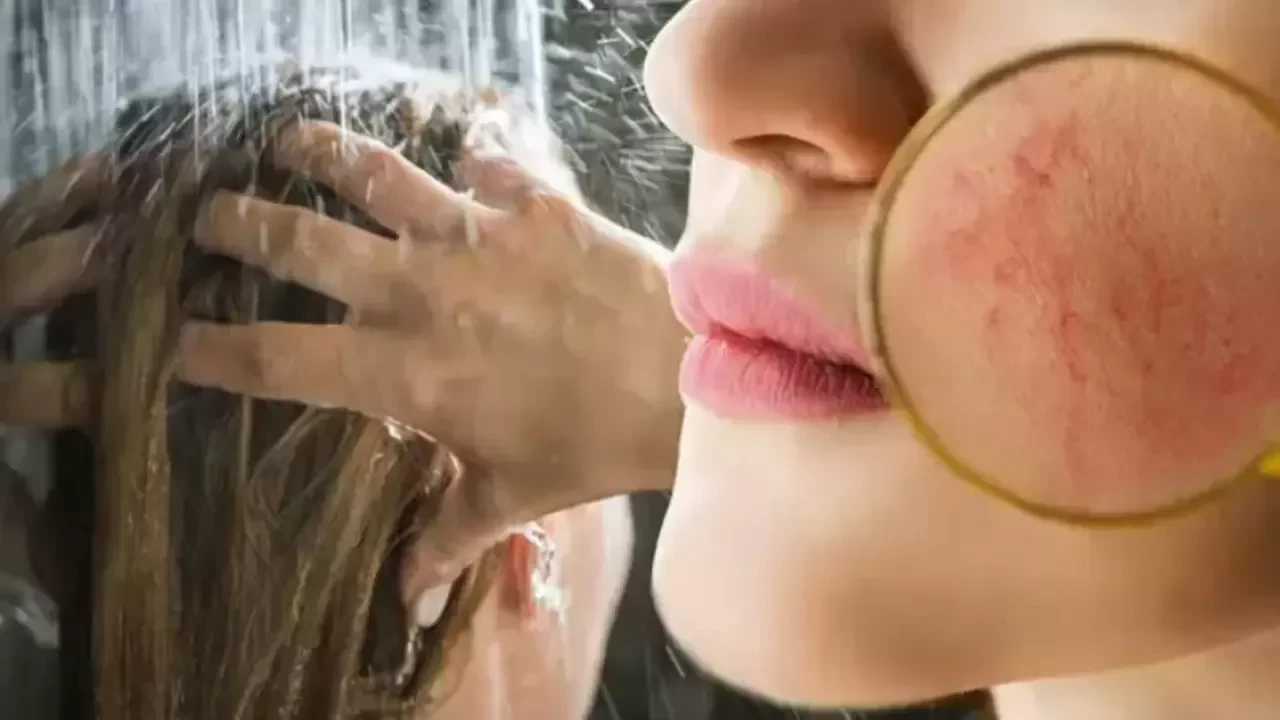 Dermatologlardan Açıklama: Her Gün Duş Almak Sanıldığı Kadar Zararlı Değil!