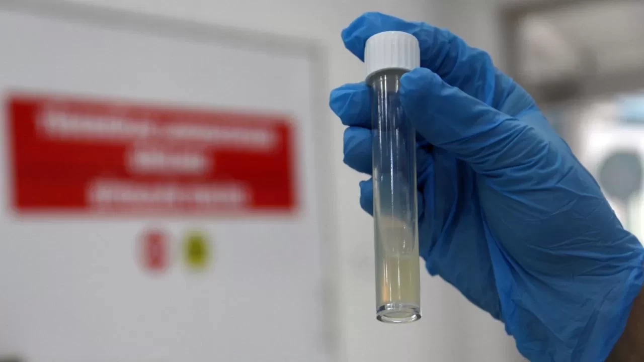 Tüberküloz hastalarına yakın takip