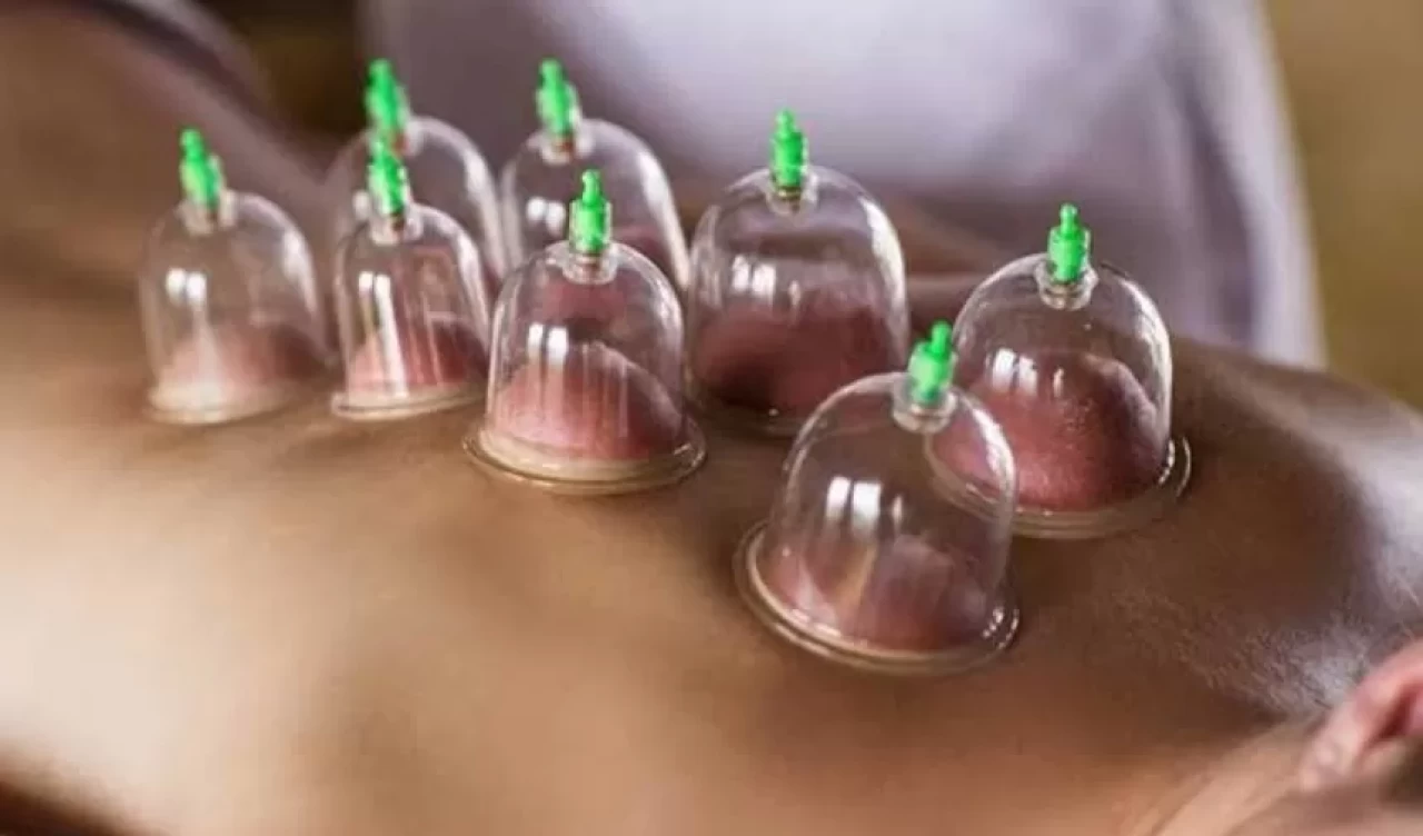 Hacamatın cilde faydaları: Geleneksel yöntemle doğal güzellik